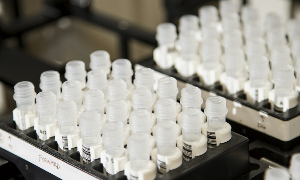 Trenbolon: oestrogene en progestagene activiteit